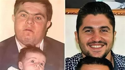 بعد أن أصبح طبيب أسنان سوري يوجه رسالة لوالده المصاپ بمتلازمة 