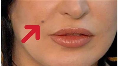 هل تعلم ماذا تعني وجود الشامات علي جسم الانسان لن تصدق ذلك ابدا 